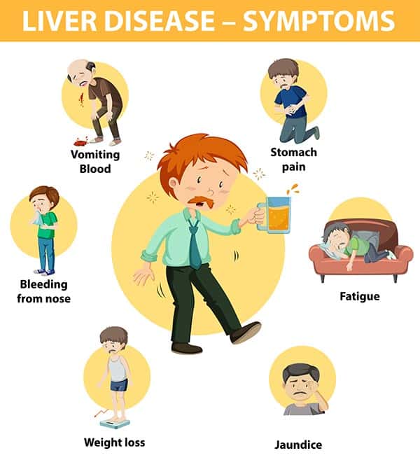 Symptoms of liver disease and cirrhosis of the liver